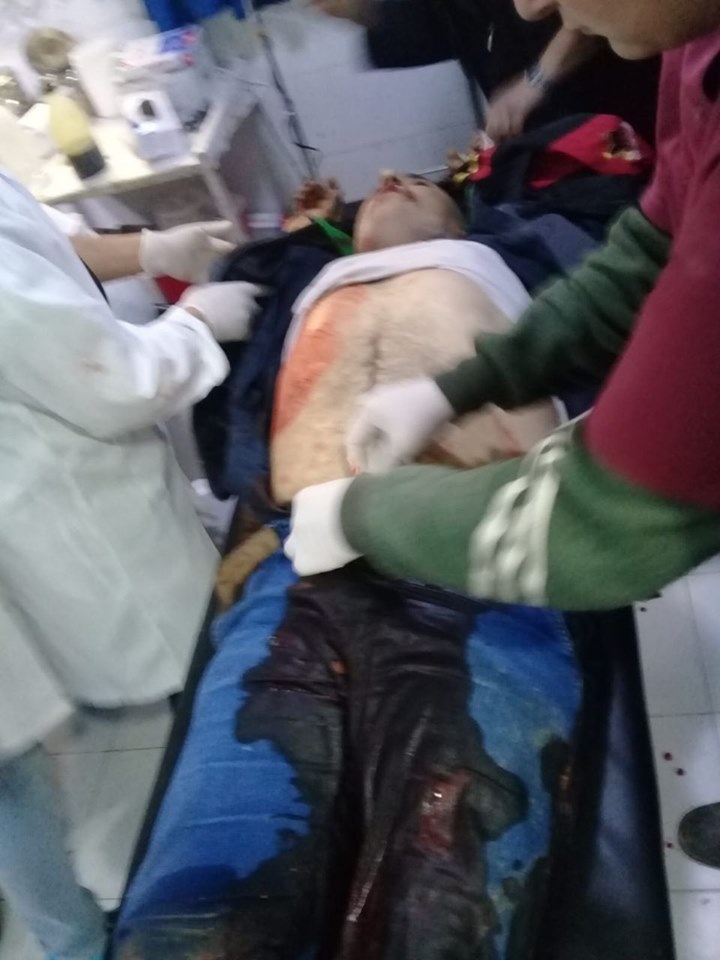 Efrîn tê topbarankirin.. Qurbanî hene